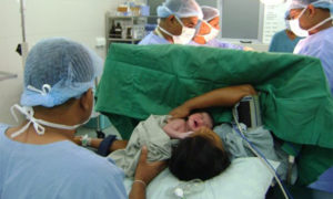 Los partos vaginales son cada vez menos frecuentes en el país. Nueve de cada diez partos de clínicas son por cesárea.