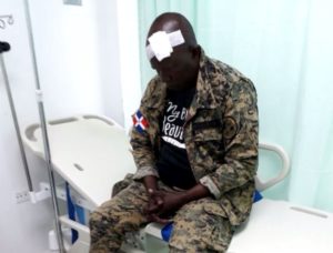 El miembro del Ejército de la República Dominicana tiene el rango de sargento mayor y fue herido de una pedrada en la cabeza en Pedernales