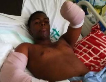 Yeison Santos, a quien jóvenes le cercenaron un brazo tras un juego de baloncesto.