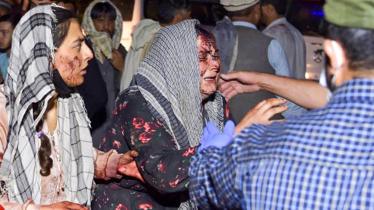 Mujeres heridas llegan a un hospital para recibir tratamiento después de dos explosiones frente al aeropuerto de Kabul el 26 de agosto de 2021. (Wakil KOHSAR / AFP)