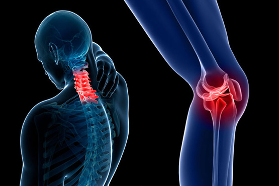 Osteoartritis