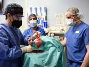Medicos implantan por primera vez un corazón de cerdo a un humano