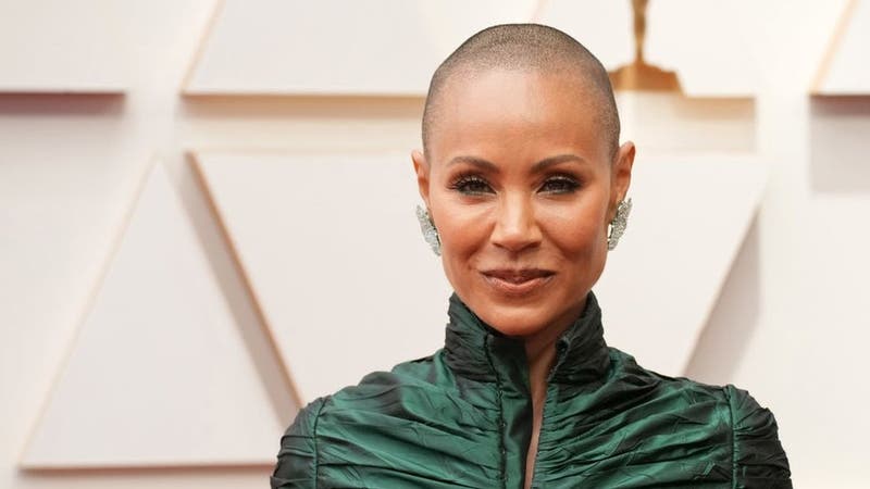 La alopecia de Jada Pinkett podría ser un trastorno genético y autoinmune