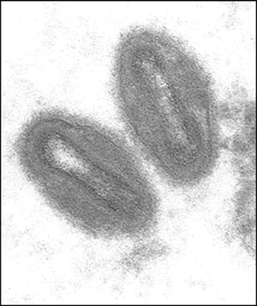 Viruela del mono: qué es, cómo se contagia, cuáles son sus síntomas