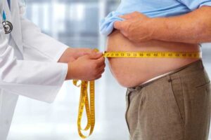 La Obesidad se define como una acumulación anormal o excesiva de grasa que puede ser perjudicial para la salud.